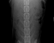 (4) 7 měsíců VD 2