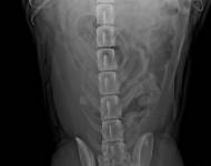 Americký stafordširský teriér (VD)