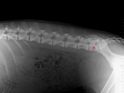 Lumbosakrální přechodový obratel